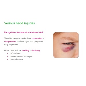 E-learning example - serious head injuries